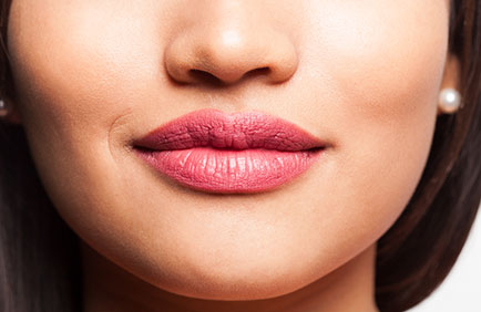 Dra Debora Reis – Lip Lift Resultado estético de lip lift com lábios definidos, simétricos e visualmente rejuvenescidos
